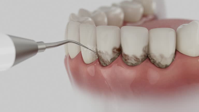 Reliable Dental contractor in Wheaton, MN by Dentist Open Now
